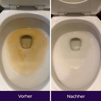Vorher-Nachher-Darstellung Emily – Anbieter-Werbematerial