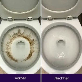 Vorher-Nachher-Darstellung Lisa – Anbieter-Werbematerial